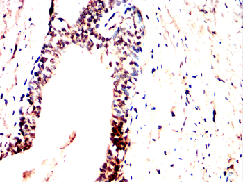 FHIT Antibody