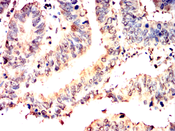 FHIT Antibody