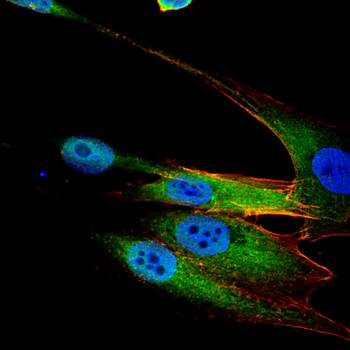 ADK Antibody