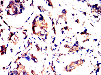 ADK Antibody