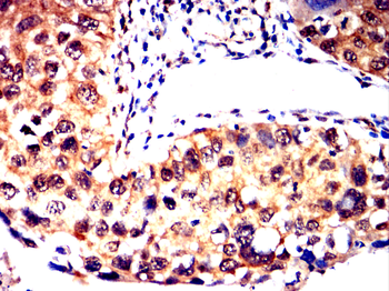 ADK Antibody