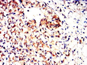 ADK Antibody