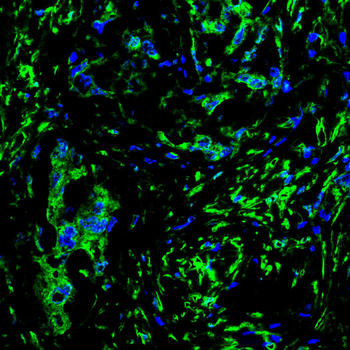 ADK Antibody