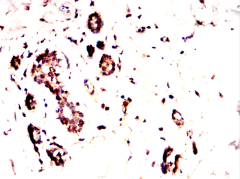 HIF1AN Antibody