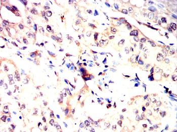 HIF1AN Antibody