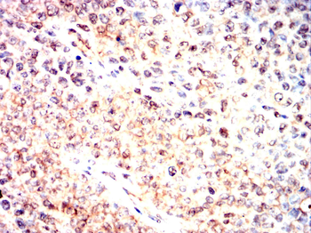 HIF1AN Antibody
