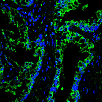 HIF1AN Antibody