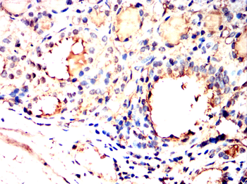 HIF1AN Antibody