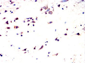 DPYSL5 Antibody