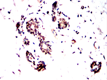 FUBP3 Antibody