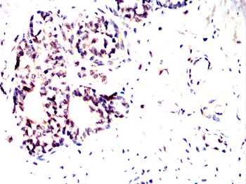 FUBP3 Antibody