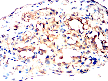 PPT1 Antibody