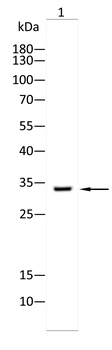 PPT1 Antibody