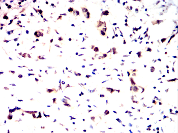 BANP Antibody