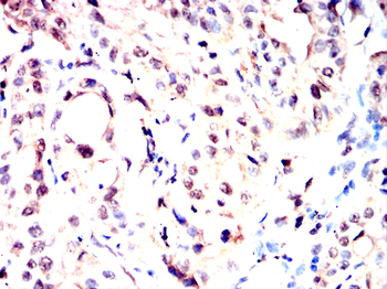 BANP Antibody