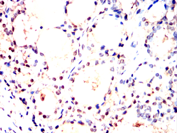 BANP Antibody