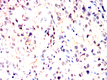 MCM3 Antibody