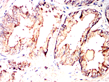GARS1 Antibody