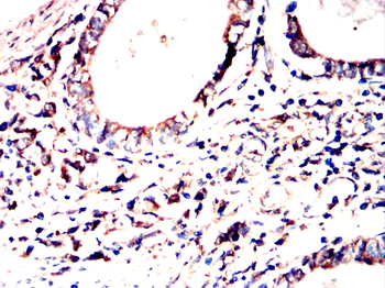 GARS1 Antibody