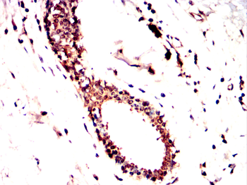 CLIC4 Antibody