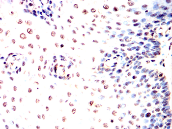 ACHE Antibody
