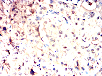 ACHE Antibody