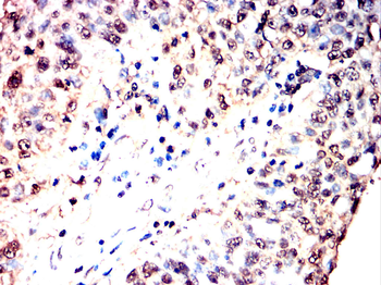 ACHE Antibody