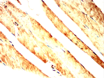 CNN1 Antibody