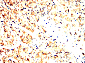 CNN1 Antibody