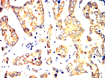 KL Antibody