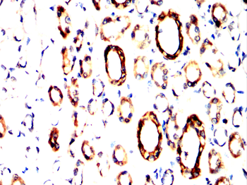 KL Antibody