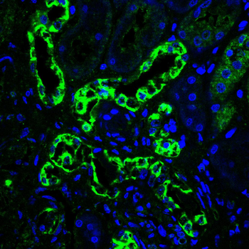 KL Antibody