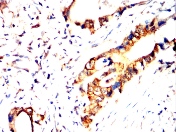 KL Antibody