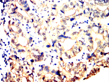KL Antibody