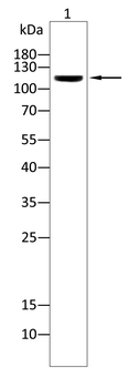 KL Antibody