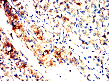 SCARB1 Antibody