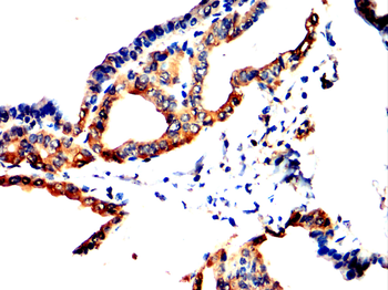 SCARB1 Antibody