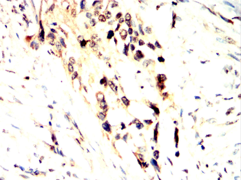STAT5A Antibody