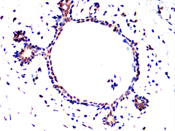 NFKB1 Antibody