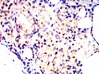 NFKB1 Antibody