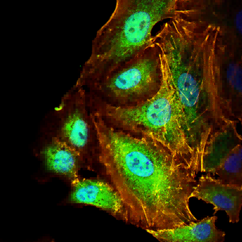 HSPB8 Antibody