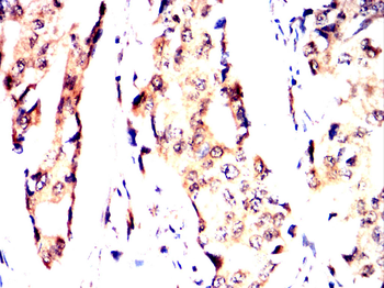 HSPB8 Antibody