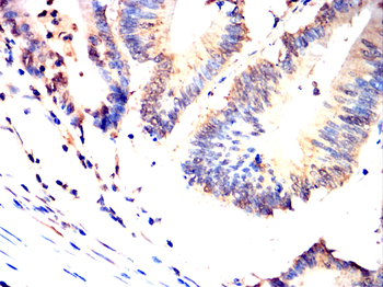 HSPB8 Antibody