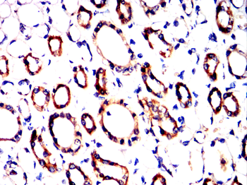 HSPB8 Antibody