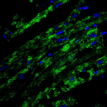 HSPB8 Antibody