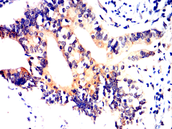 HSPB8 Antibody