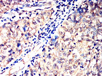ADAMTS13 Antibody