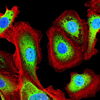 SGCG Antibody
