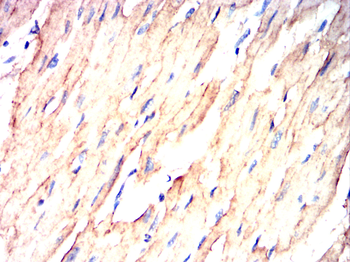 SGCG Antibody