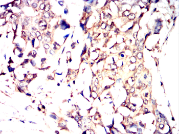 SGCG Antibody